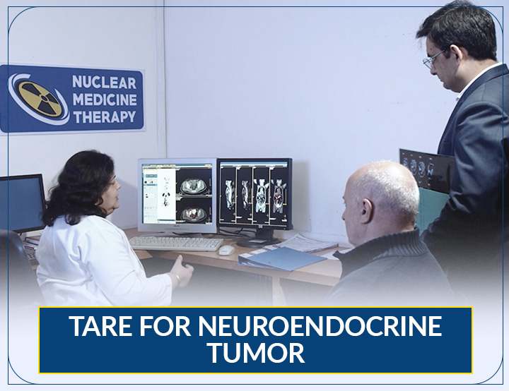 TARE for Neuroendocrine Tumor